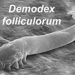 Demodex Mites: The Link to Chronic Dry Eye Issues