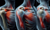 Acupuncture Techniques for Relieving Frozen Shoulder