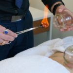Cupping Therapy in Melbourne: Unveil Its Healing Advantages