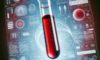Vitamin B12 Blood Test: A Guide for Residents of Bridlington