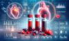Cholesterol Blood Test: A Vital Health Guide for Milton Keynes