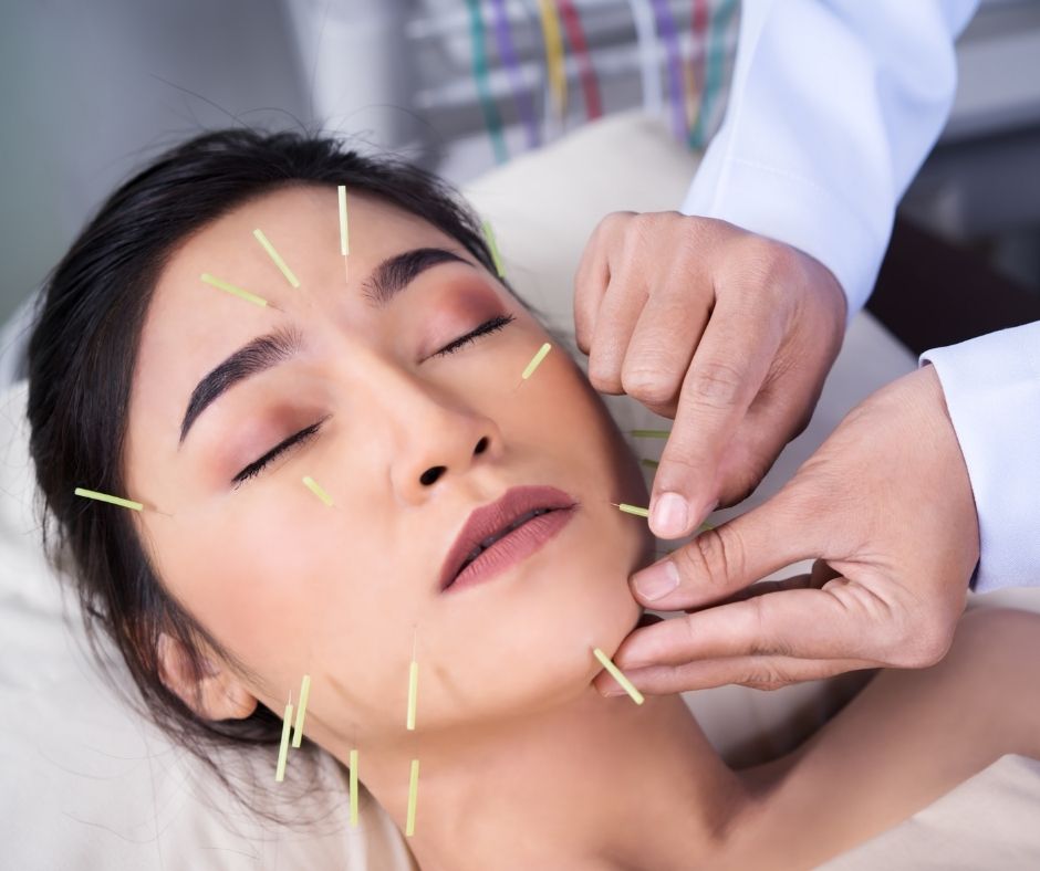 Cosmetic Acupuncture: Important Drawbacks to Consider